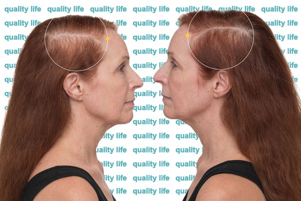 Gür ve Canlı Görünüm